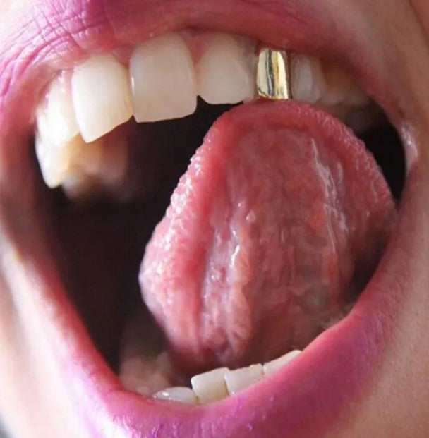 Luxe Gold Tooth Cap